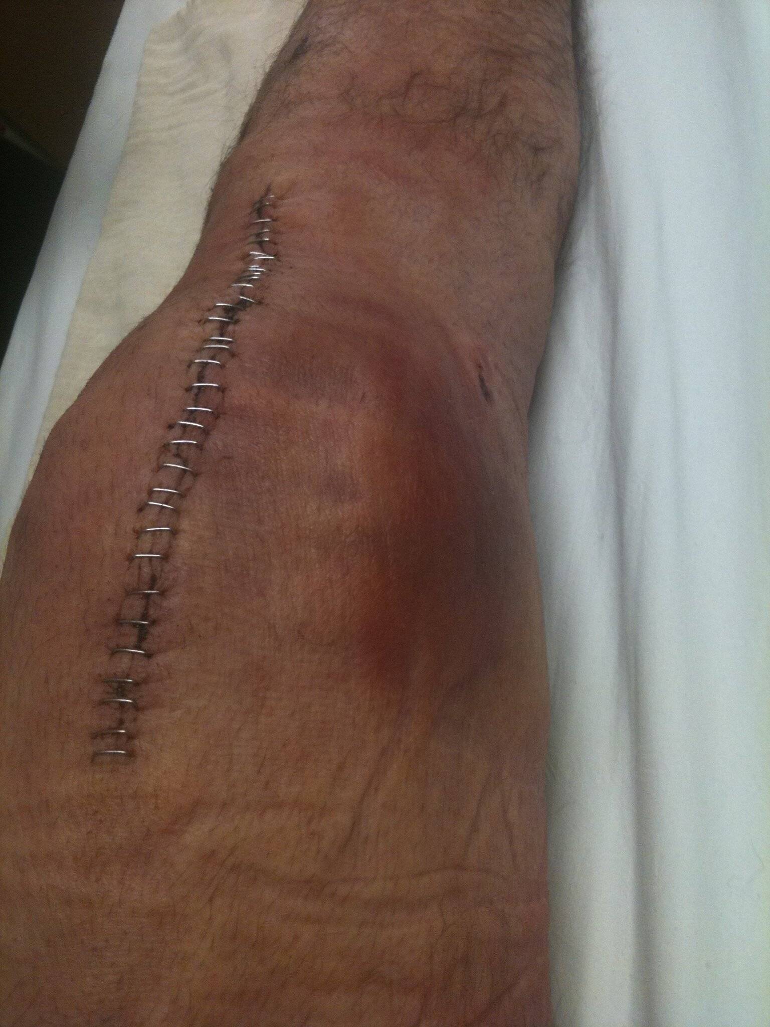 Ford Bronco Sport Any other Goalies in the forum? Knee 2.JPG