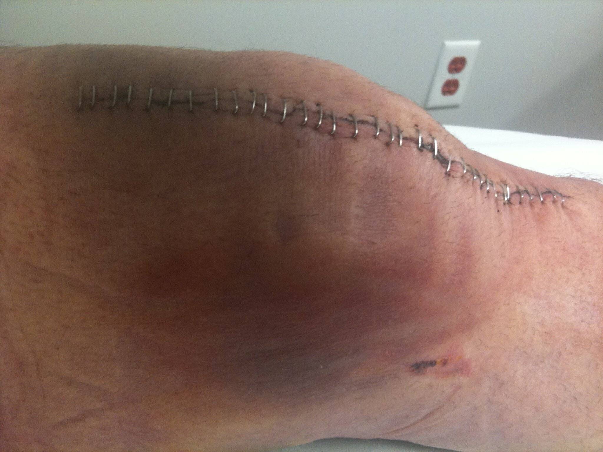 Ford Bronco Sport Any other Goalies in the forum? Knee 3.JPG