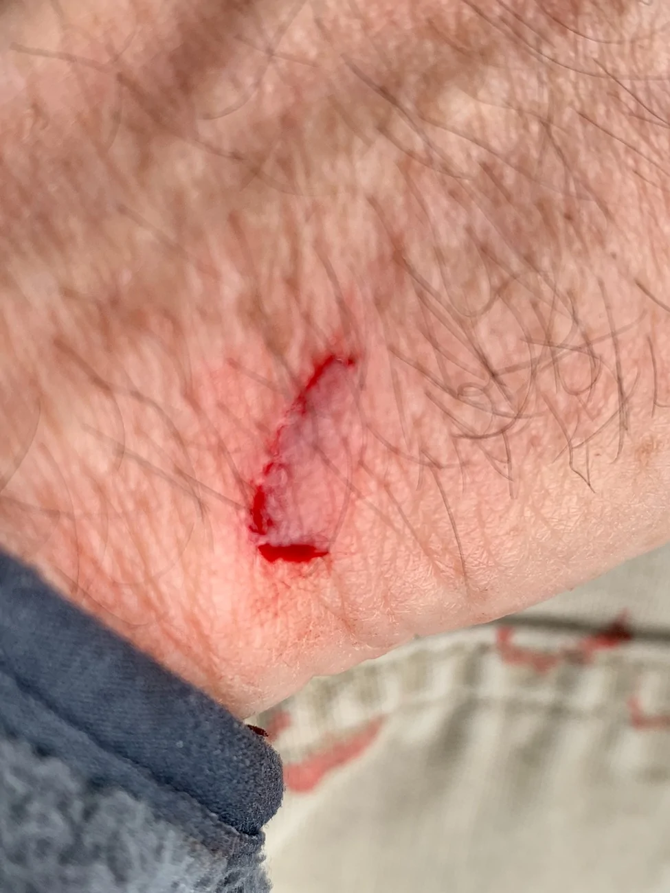 Ford Bronco Sport 2025 Bronco Sport Big Bend  Sharp metal in engine compartment .  Ford Motor Company contacted. IMG_3813